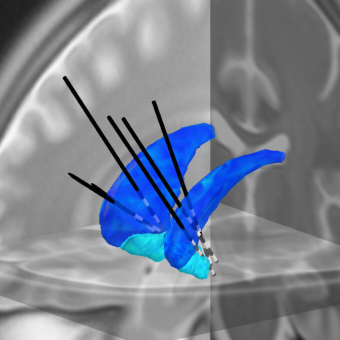 Neuroimaging figure